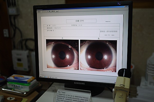 眼球検査